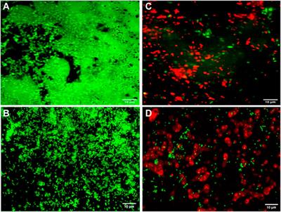 Synergistic and antibiofilm potential of Curcuma aromatica derived silver nanoparticles in combination with antibiotics against multidrug-resistant pathogens